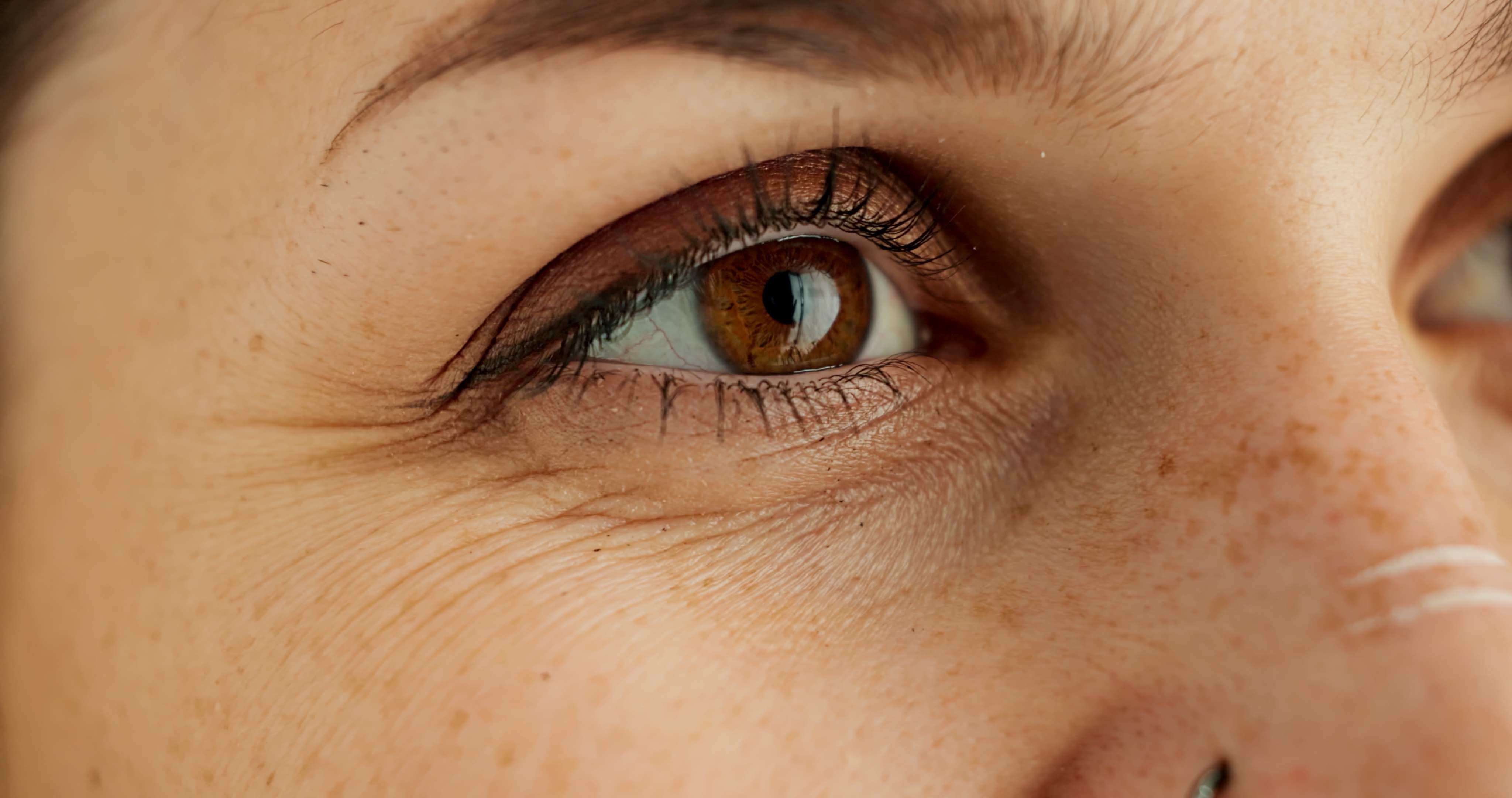 Falten und Volumenverlust